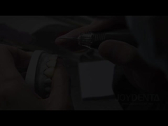 Çimçek Fineri Doğal Şeffaf Diş Finerleri için Mükemmel Çözüm