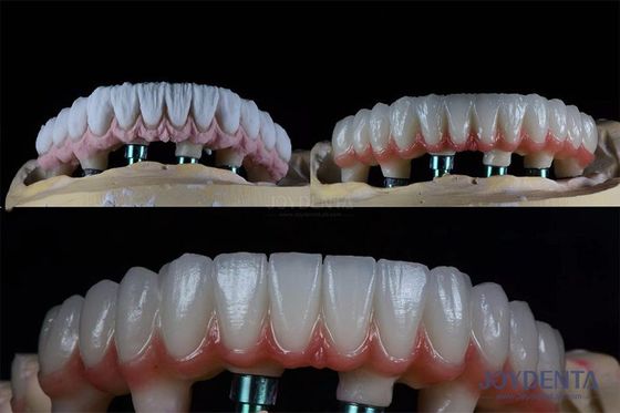 satın al Endosöz protez tacı için 10 mm çoklu diş iki aşamalı diş implantı kiti Çevrimiçi üretim