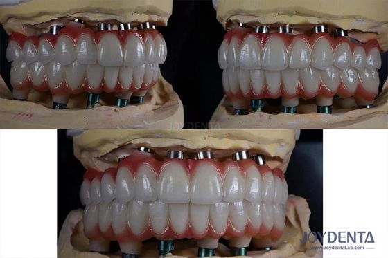 satın al 10 mm Titanyum Çoklu Diş İmplantı Diş Restorasyonu için Kaba Yüzey Çevrimiçi üretim