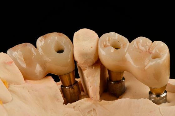 satın al Kendini Tapping 3.0mm Thread Dental Titanyum İmplant Optimized Fonksiyonel Çevrimiçi üretim