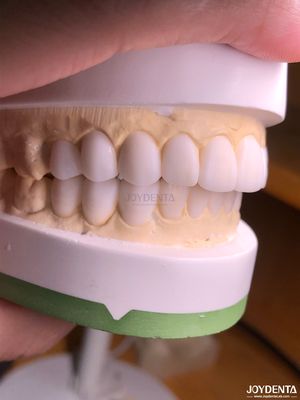 satın al Doğal diş anatomisini çoğaltmak için özelleştirilmiş dijital teşhis balmumu Çevrimiçi üretim