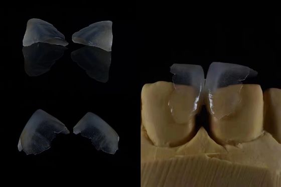 satın al Konforlu Diş Yaprakları Sağlıklı Uyum İçin Diş Enameline Güçlü Bağlama Hasta Rahatlığı İçin Hafif Ve Yumuşak Çevrimiçi üretim