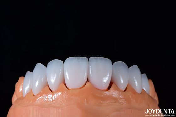 satın al 0.3-0.5mm Kalınlığı Emax Porselen Fineri Yüksek Parlaklıklı Kozmetik Diş Hekimliği için Çevrimiçi üretim