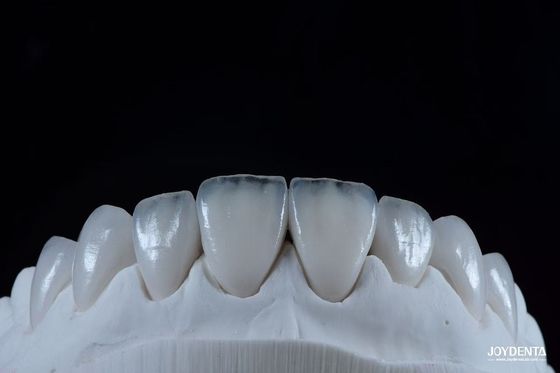 satın al Doğal Görünümlü Emax Porselen Fineri Rahat Fit Ultra İnce Emax Finerleri Çevrimiçi üretim