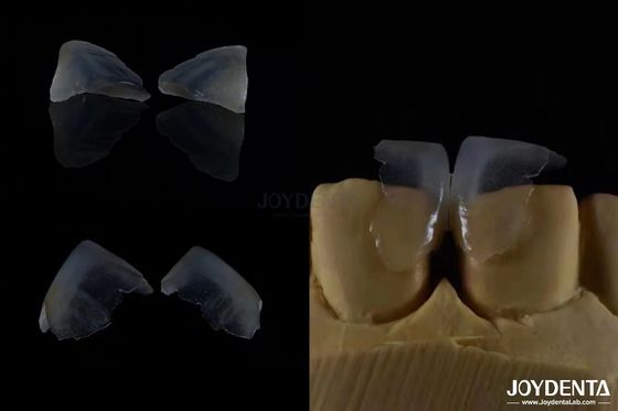 satın al Minimal invaziv kozmetik diş kaplamaları cam seramik renk ultra ince Çevrimiçi üretim