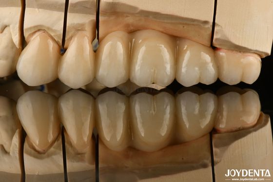 satın al Doğal Görünümlü Çok Katmanlı Diş Restorasyonları için Tam Zirkonya Ultra Şeffaf Çevrimiçi üretim