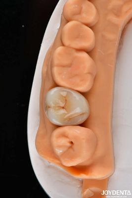 satın al Dental çok katmanlı tam zirkonya taçlar ve köprüler yüksek şeffaf doğal görünüm Çevrimiçi üretim