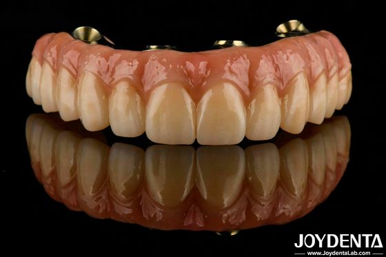 satın al Dental Ti-Bar Hibrit Zirkonya Köprüsü Mükemmel Dayanıklılık Çiğneme Fonksiyonunu Geri Alıyor Çevrimiçi üretim