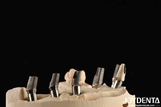 satın al Özel yapılmış cilalı titanyum abutment çimento retetion V şeklinde iplik türü Çevrimiçi üretim