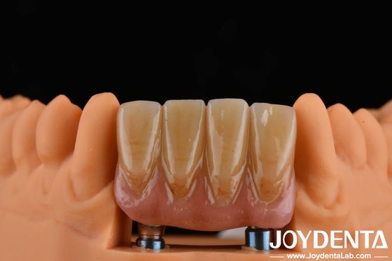 satın al 4.5 mm Yükseklik Bitmiş Abutments İç Hex Bağlantı Tipi İmplant Sistemleri ile Uyumlu Çevrimiçi üretim