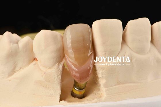 satın al 0° açılandırma bitmiş diş abutments 1.5mm iplik pitch cilalanmış yüzey Çevrimiçi üretim