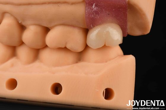 satın al 4.1mm V şeklindeki iplik titanyum abutments iç hex bağlantısı ile Çevrimiçi üretim