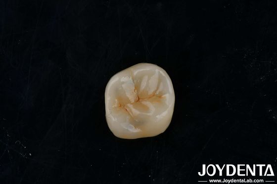 satın al Özelleştirilebilir yapıştırıcı zirkonya yapıştırmaları Onlays Restorasyon için yüksek şeffaflık Çevrimiçi üretim
