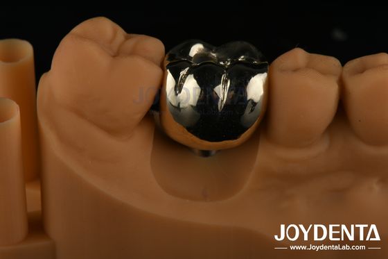satın al Ağız Rehabilitasyonu Balmumu dökme FMC Dental Klinik Onarım için Tam Metal Taç Çevrimiçi üretim