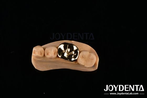 satın al Metal FMC Oral Clinical Repair Sıkıştırma Dayanıklı Diş İmplantı Malzemeleri Çevrimiçi üretim