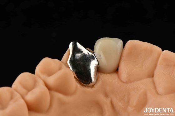 satın al Özelleştirilebilir Metal Malzemesi PFM Maryland Diş Bakımı Oral Klinik Onarım Çevrimiçi üretim