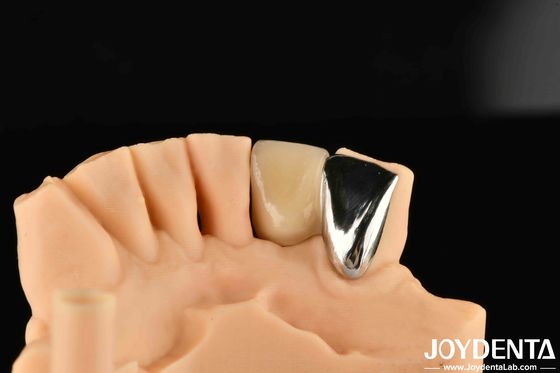 satın al Dental Metal / Maryland Bridege Oral Klinik Onarım Metallik İdeal Renk Klinik Bağlama Çevrimiçi üretim