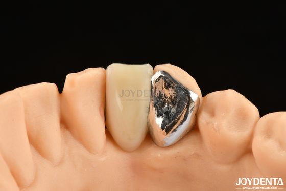 satın al İdeal Eşleşme Klinik Bağlama Maryland Diş Hekimi Oral Klinik Tamir İşleri için Çevrimiçi üretim