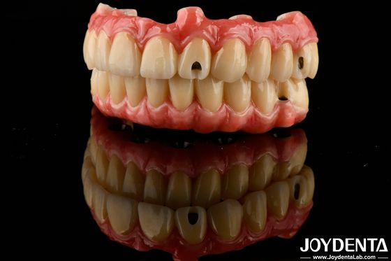 satın al Mükemmel Elastiklik Diş Akrilik Dentüel Dentüel Dentüel Dentüel Dentüel Dentüel Dentüel Dentüel Dentüel Dentüel Dentüel Dentüel Dentüel Dentüel Dentüel Dentüel Dentüel Dentüel Dentüel Dentüel Dentüel Dentüel Dentüel Dentüel Dentüel Dentüel Dentüel Dentüel Dentüel Dentüel Dentüel Dentüel Dentüel Dentüel Dentüel Dentüel Dentüel Dentüel Dentüel Dentüel Dentüel Dentüel Dentüel Dentüel Dentüel Dentüel Dentüel Dent Dentüel Dentüel Dent Dentüel Dent Dentüel Dent Dentüel Dent Dentüel Dent Dent Dentüel D Çevrimiçi üretim