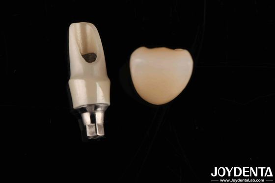 satın al Zirkonya Özel Abutment ve Barlar Bireysel Hasta Anatomi için Diş Restorasyonları Çevrimiçi üretim
