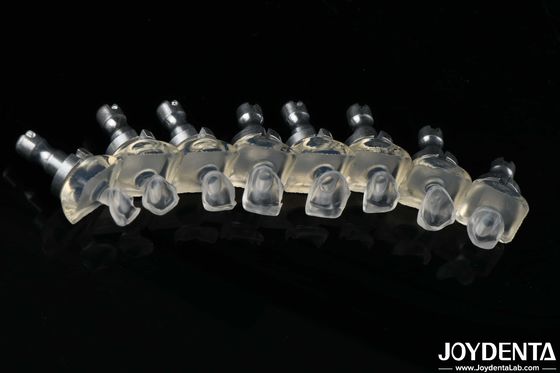 satın al Yüksek şeffaflıklı cam porselen diş kaplamaları Yüksek dayanıklılık 0.3-0.8 mm Kalınlık Çevrimiçi üretim