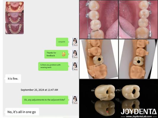 satın al Uzun süreli tam kemerli diş implantları Endosöz implant uzunluğu 10mm-16mm Çevrimiçi üretim