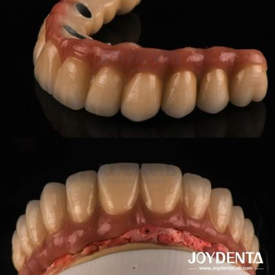 satın al Atma ve freze PFM Diş Tacı, Diş Restorasyonları Porselen Erimiş Metal Tacı Çevrimiçi üretim