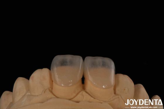 satın al Çevre dostu Mikro Diş Fineri 0.2mm Kalınlık Yumuşak doku Çevrimiçi üretim