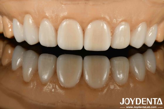 satın al Yüksek Gizlilik Çeşitli Malzemeler Metaller ve reçinler Esnek Diş Ekimi Gelişmiş Gizlilik Teknolojisi İçin Çevrimiçi üretim