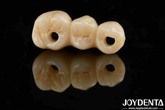 satın al Yüksek Estetik Yüksek bükme dayanıklılığı 1000 MPa Standartlar için tam zirkonya Çevrimiçi üretim