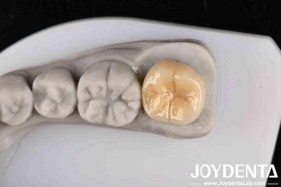 satın al Sıcak şoka ve korozyona karşı yüksek dirençli mükemmel kimyasal istikrarlı tam zirkonya Çevrimiçi üretim