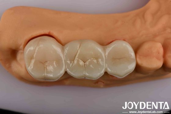 satın al Doğal görünümlü estetik için en iyi çözümünüz yüksek dayanıklılıklı diş zirkonisi Çevrimiçi üretim