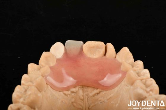 satın al Yüksek Gizlilik İyi Elastiklik Çeşitli Üretim Süreçleri İçin Esnek Diş Dişleri Çevrimiçi üretim