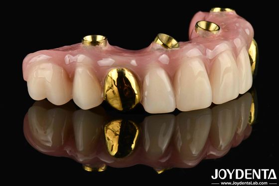 satın al 50 ml Amerika Birleşik Devletleri'nden Dentwre En İyi Çözümünüz Diş Tedavisi İçin Ti-Bar Akrilik Diş Finish Çevrimiçi üretim