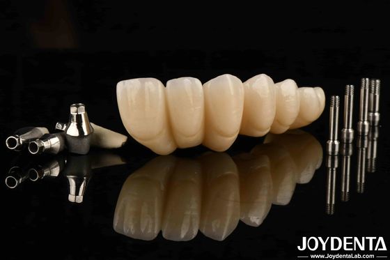 satın al Estetik açıdan hoş bir diş implantı tacı ve köprüsü ile en son estetiği deneyin. Çevrimiçi üretim