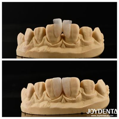 satın al Mikro Finer Yapılandırması Kolay İç Dekorasyon için En İyi Çözüm 0.2mm Kalınlığı Çevrimiçi üretim