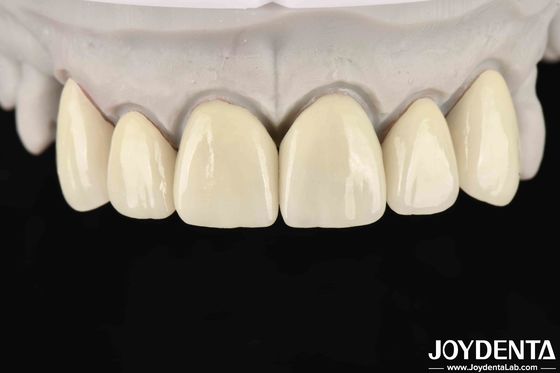 satın al 6.0-6.1 G/cm3 CAD / CAM frezeleme yüksek şeffaflık için yoğunluk katmanlı zirkonya Çevrimiçi üretim
