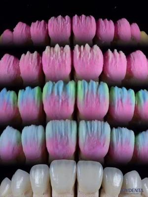 satın al The Joydenta Ceramic Veneer Process Çevrimiçi üretim