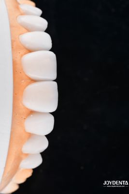 satın al Enhance Case Acceptance & Patient Communication with Our Diagnostic Wax-Up Service Çevrimiçi üretim