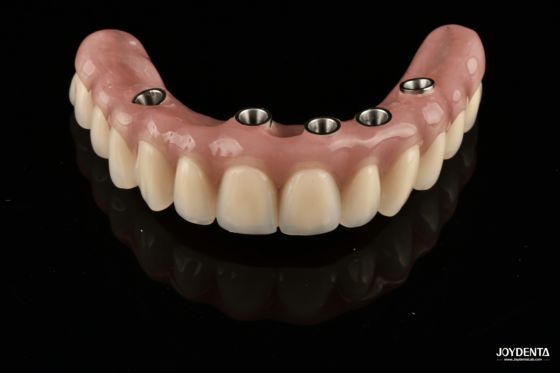 satın al Redefining Full Arch Prosthetics: Unmatched Fit and Function with Our Ti-Base Complete Dentures Çevrimiçi üretim