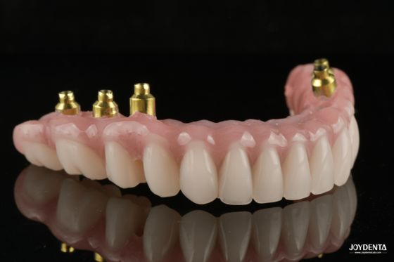 satın al The Strength of Titanium, The Art of Natural Aesthetics. Çevrimiçi üretim