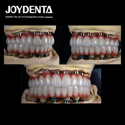 satın al 10 mm Titanyum Çoklu Diş İmplantı Diş Restorasyonu için Kaba Yüzey Çevrimiçi üretim