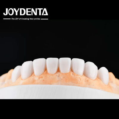 satın al Enhance Case Acceptance & Patient Communication with Our Diagnostic Wax-Up Service Çevrimiçi üretim