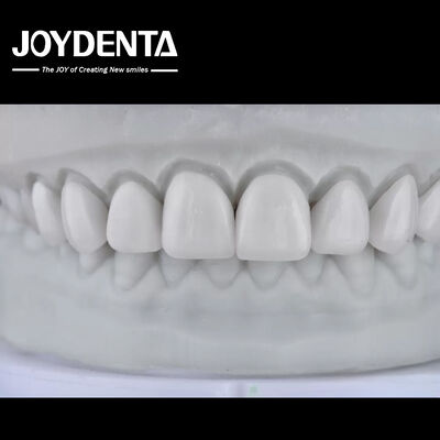 satın al Visualize the Result, Secure the Case: Our Diagnostic Wax-Up Service Çevrimiçi üretim