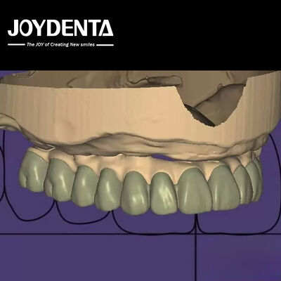 satın al Bireysel Tasarım Dijital Tanısal Balmumu Laboratuvar Yazılımı Kesintisiz Entegrasyon Çevrimiçi üretim