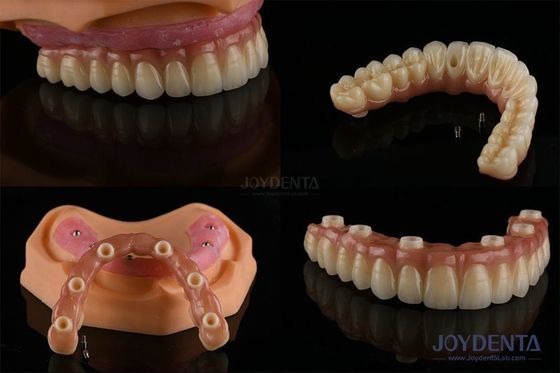 Ivoclar İmplant Top Bağlantıları Ağız Hijyeni İçin Çıkarılabilir Diş İmplantı Malzemesi