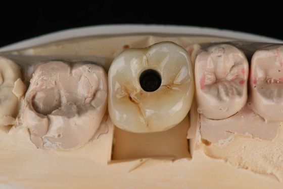 Titanyum 10mm Tek Dişli Diş İmplantları Değiştirme Abutment Kendini Tapping Kumlu