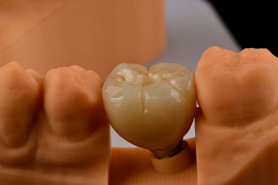 Oral Implantoloji Kendi Kendine Tapping Tek Dişli Diş İmplantları İç Hex Bağlantısı