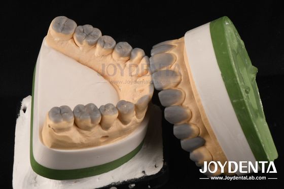 Yüksek hassasiyetli geçici diş teşhisi balmumu özel 1-2 mm kalınlığı