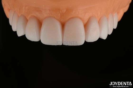 Yumuşak Replikasyonlu Tanısal Balmumu FDA, Tam Kemerli Diş Balmumu Yüksek Hassasiyetli